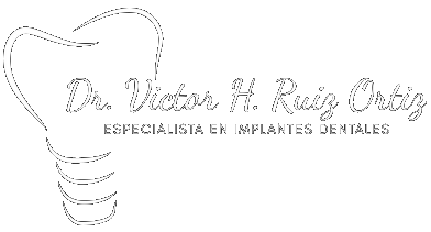 Implantes Dentales Zacatecas